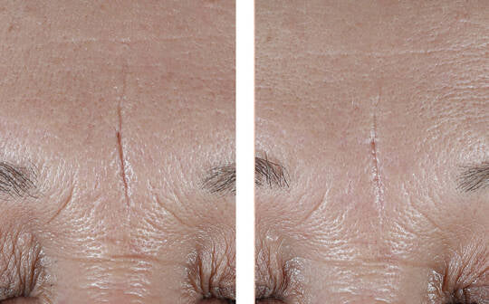 SkinBetter Interfuse Treatment Face&Neck