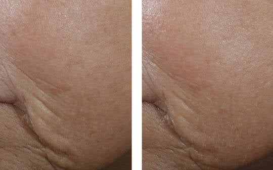 SkinBetter Interfuse Treatment Face&Neck