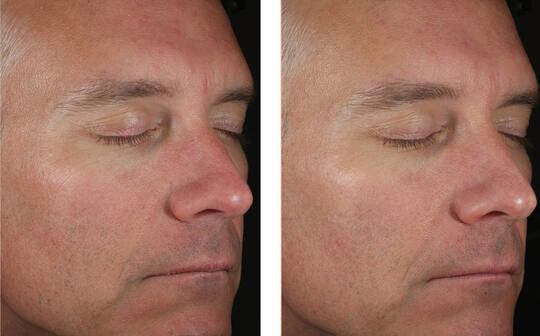 SkinBetter Solo Hydrating Defense MEN