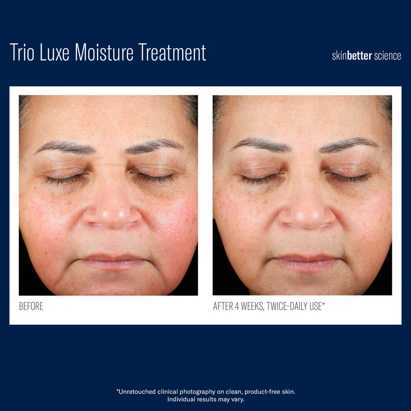 SkinBetter TRIO Luxe