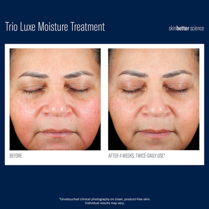 SkinBetter TRIO Luxe