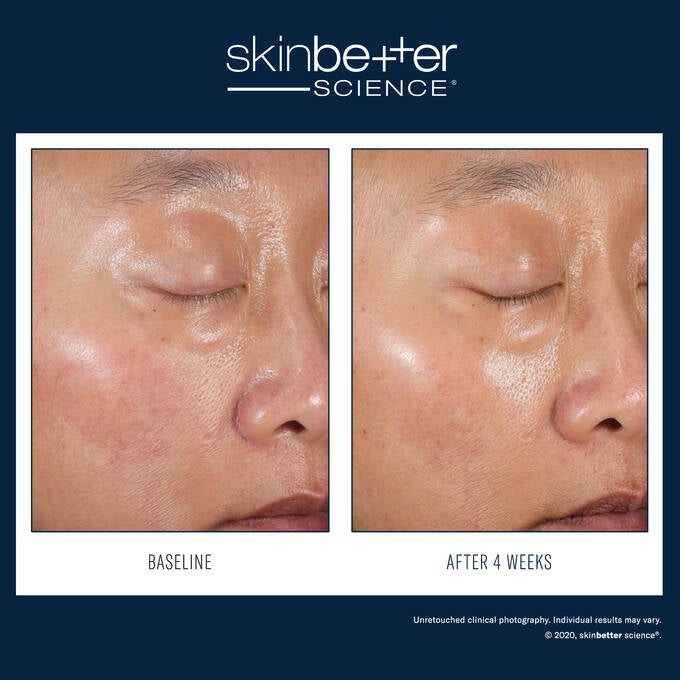 SkinBetter Duo Kit